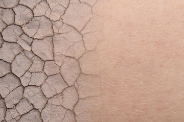 Skincare for dry skin