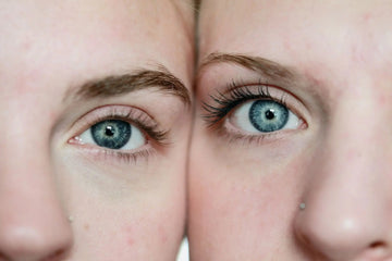 Hvad er uren hud? - S:KØN Skincare